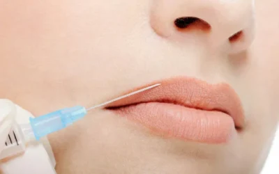 Innovación en Aumento de Labios: La Revolución Tecnológica en Aparatología Estética