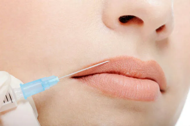 Innovación en Aumento de Labios: La Revolución Tecnológica en Aparatología Estética